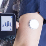 Flash glucose monitoring – novinka na trhu kontinuálního glukózového monitoringu